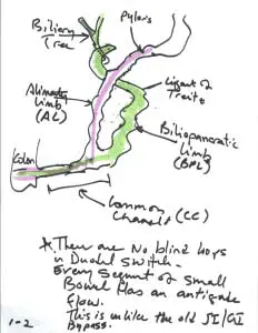 image18001-232x300-min Duodenal Switch anatomy