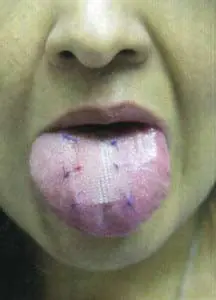 Tongue