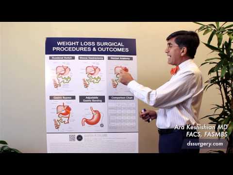 Weight Loss Surgical Procedures Part 1- Normal Anatomy
