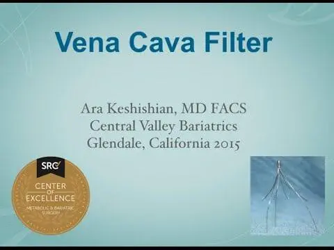 Vena Cava Filter