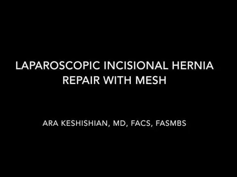 Laparoscopic Incisional Hernia Repair With Mesh