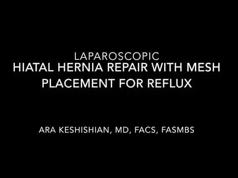 Laparoscopic Hiatal Hernia with Mesh Placement
