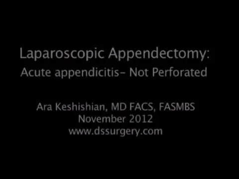 Laparoscopic Appendectomy #1