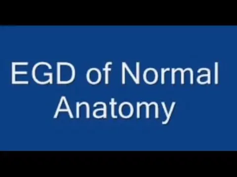 Normal Stomach and Intestinal Anatomy