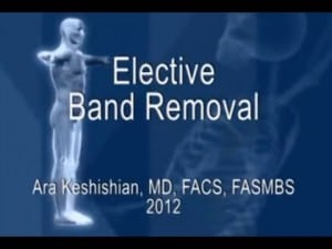 Elective Lap-Band® Removal