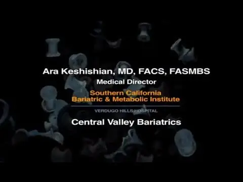 Sleeve Gastrectomy with the SILS™ procedure