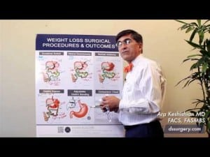 Weight Loss Surgical Procedures Part 6 - Gastric Bypass