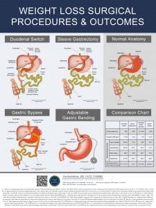 weight-loss-surgery-poster-large