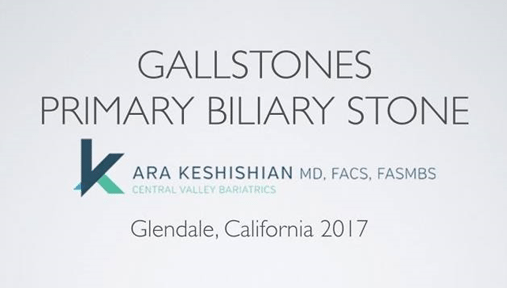 Webinar, January 2017 - Primary Biliary Stones