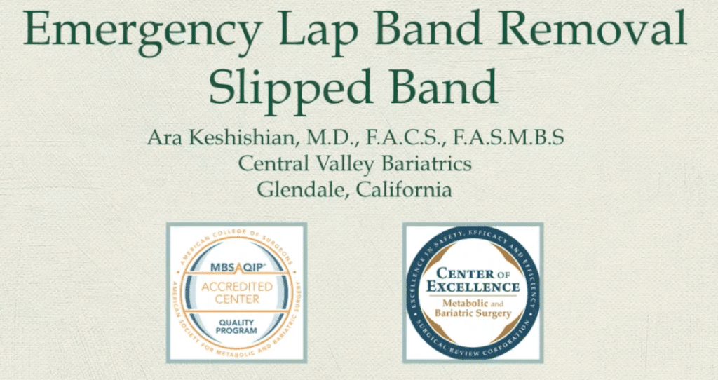 Emergency Lap Band Removal- Slipped Band