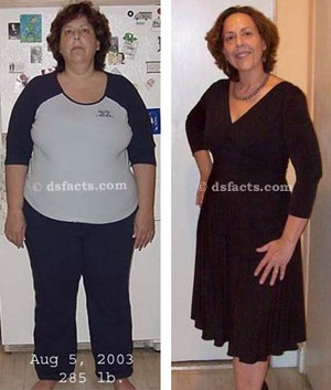 diana-before-and-after diana before and after