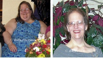 elizabeth-before-and-after elizabeth before and after