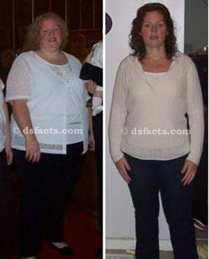 lisa-before-and-after lisa before and after