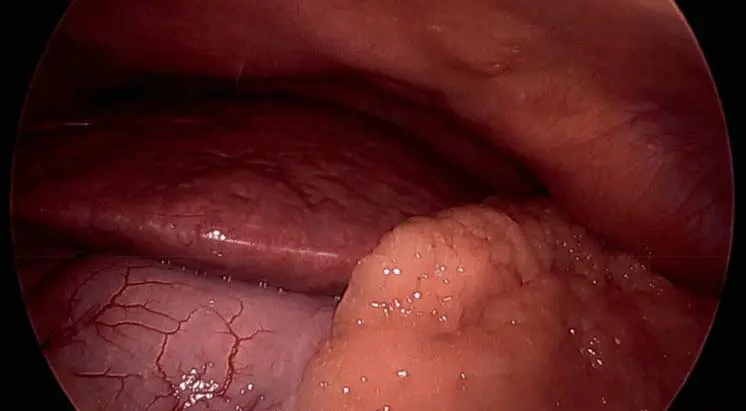 Screen-Shot-2018-04-27-at Liver Injury and Obesity