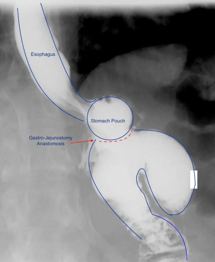 Anatomy_1 Anatomy_1
