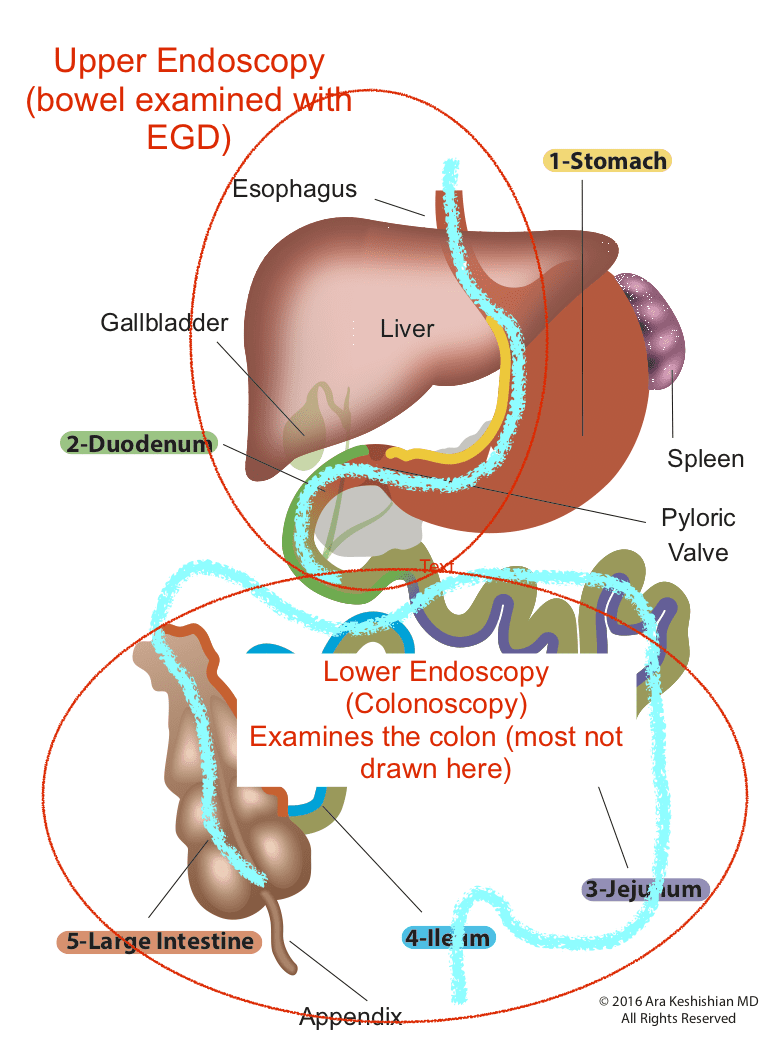Normal Anatomy Normal Anatomy