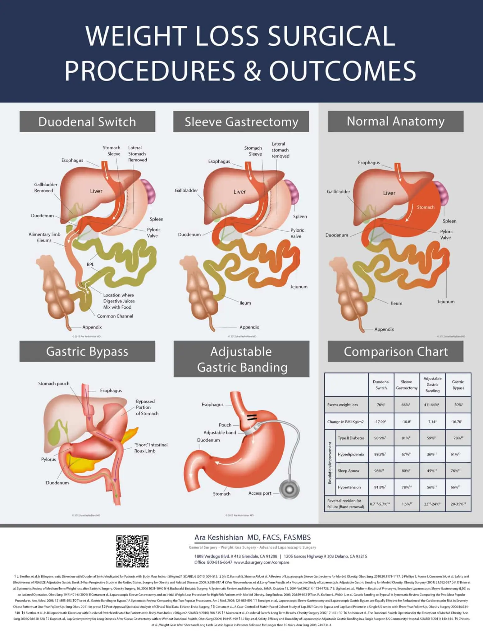Weight-Loss-Surgical-Procedures-Outcomes Weight-Loss-Surgical-Procedures-Outcomes