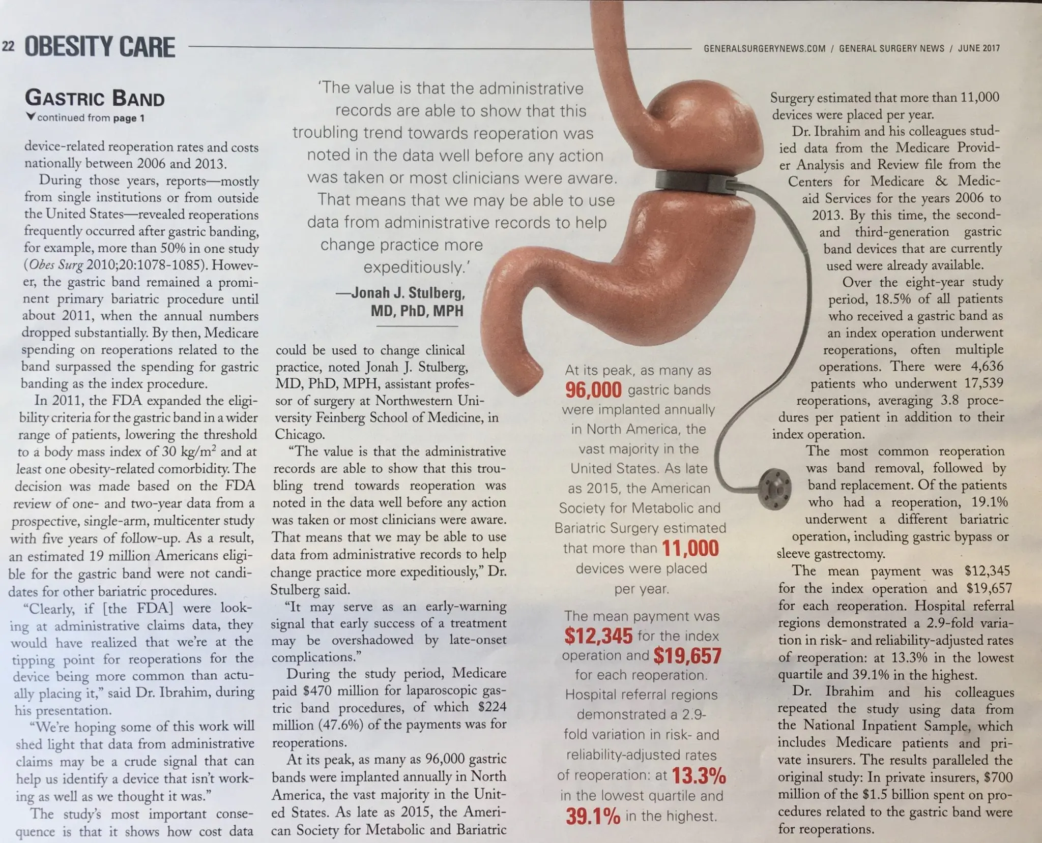 IMG_6628 (3) Gastric Band Complications article