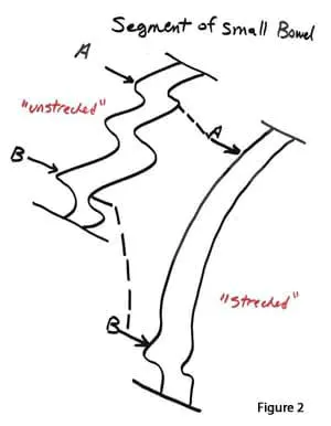length-of-small-bowel-02 length-of-small-bowel-02
