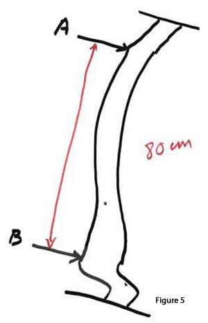 length-of-small-bowel-05