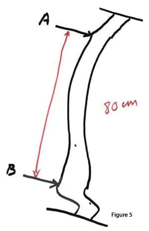 length-of-small-bowel-05 length-of-small-bowel-05