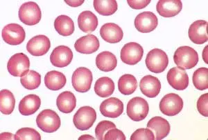 normal-blood11-300x203 Normal Red Blood Cells
