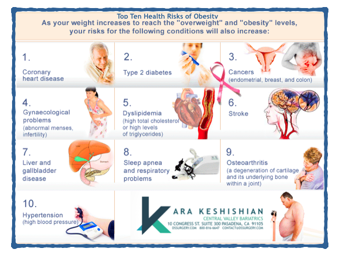 Causes of Obesity - DSSurgery