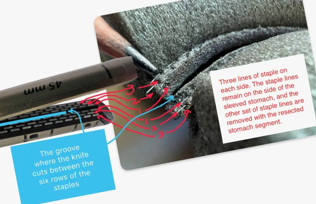 Surgical Stapling