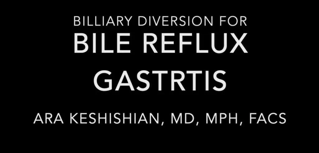 Billiary Diversion for Bile Reflux Gastrits